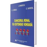 Cancerul renal cu extensie venoasa