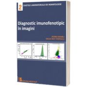 Diagnostic imunofenotipic in imagini