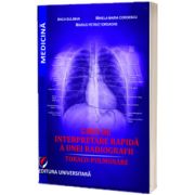 Ghid de interpretare rapida a unei radiografii toraco-pulmonare
