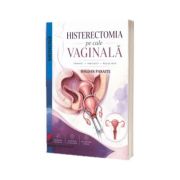 Histerectomia pe cale vaginala