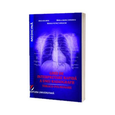 Ghid de interpretare rapida a unei radiografii toraco-pulmonare